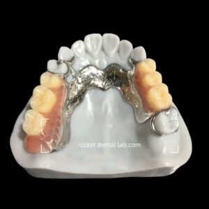 Framework/Cast Partial