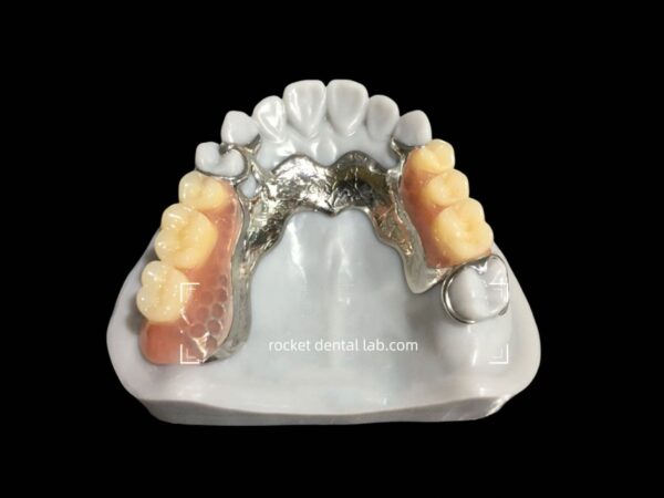 Framework/Cast Partial – rocketdentallab.com