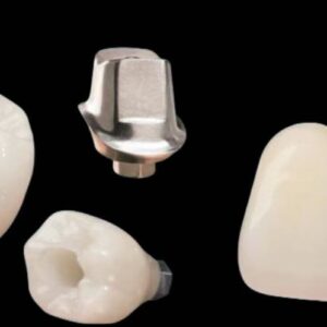 Custom Abutment