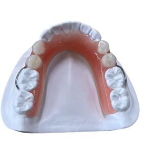 Dental Removable